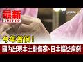 今年首例！ 國內出現本土副傷寒、日本腦炎病例【最新快訊】