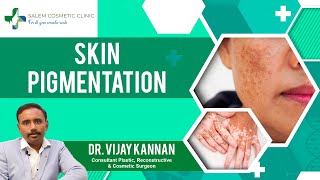 Understanding Skin Pigmentation: Causes, Types, and Solutions | Best Cosmetic Surgeon in Salem