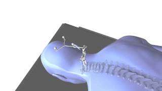 Image guided spine surgery