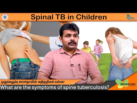 Spinal Tuberculosis in