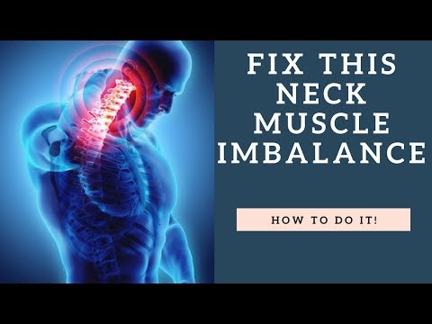 FIX This Neck Muscle Imbalance To Stop Neck Pain And Headaches