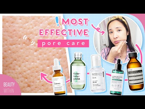 Best Products + Ingredients to Get Rid of Large Clogged Pores, Acne & Breakouts