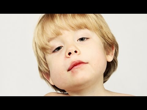 Video: Bebek sağlığı A-Z: Kabakulak