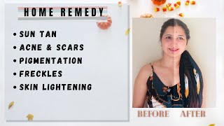 How to Remove Sun Tan Instantly| Skin lightening |Home Remedy