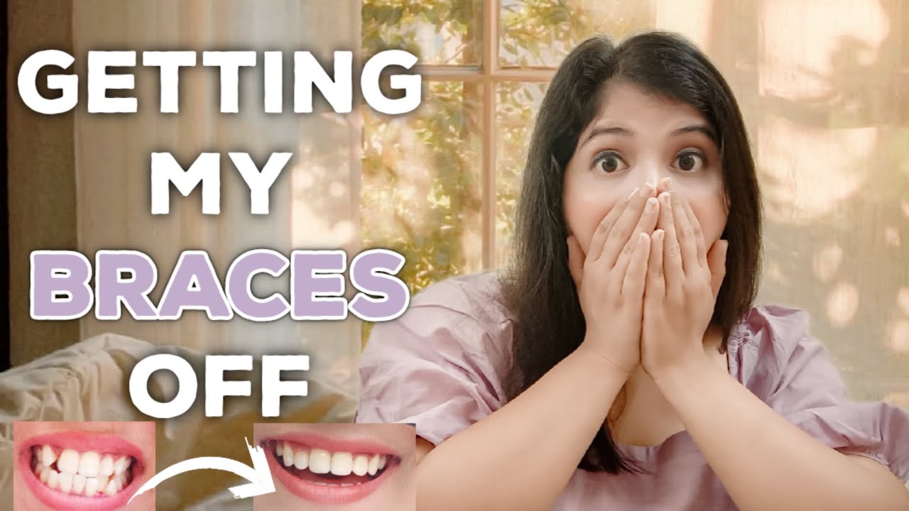 FINALLY GETTING MY BRACES OFF !! BRACES OFF AFTER 2 YEARS | TEETH TRANSFORMATION | Manya Agrawal