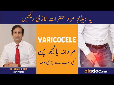 Varicocele Symptoms Treatment