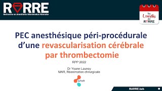 Lundi RARRE#9 : Anesthésie pour revascularisation cérébrale par thrombectomie