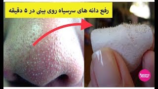 چگونه دانه های سرسیاه روی بینی رو در ۵ دقیقه رفع کنیم