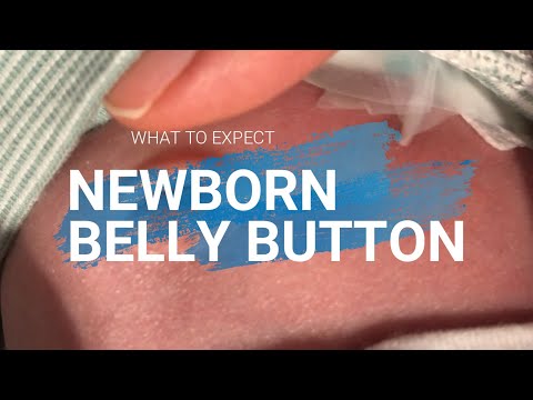 Newborn belly button signs of infection, What&rsquo;s normal healing, Should I call doctor, What to expect