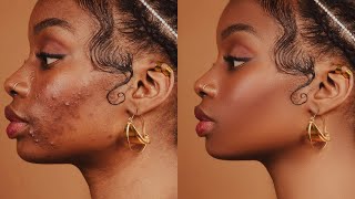 High-End Skin Retouching Beginner Photoshop Tutorial | Frequency Separation screenshot 3