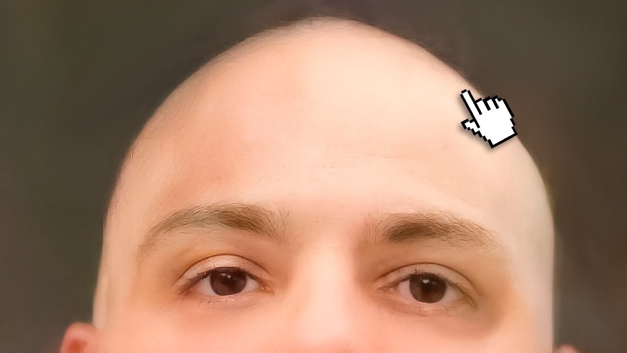 T3ddy careca  Cara de decepção, Cara, Careca