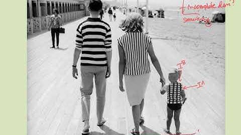 Modifications to Mendelian Inheritance: one gene