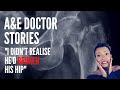Story time: I nearly missed a broken hip | emergency department doctor | Dr Sarah Nicholls