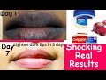 How to get permanent pink  plump  soft lips naturally in 3 days very fastdiy lips