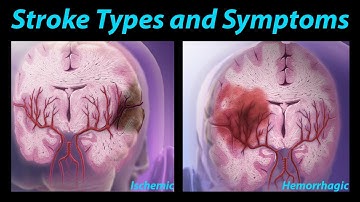Visible Body | Stroke Types and Symptoms