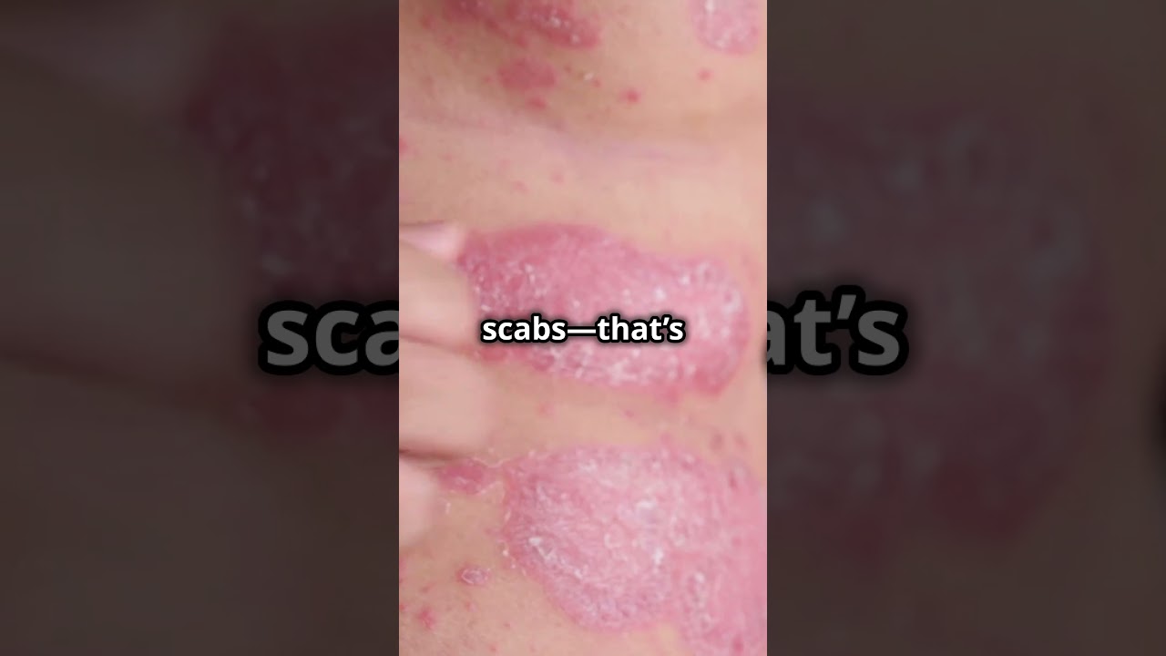 Могут ли кошки получить солнечный ожог? Удивительная правда! 