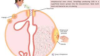 Streptococci Gram positive cocci
