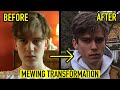 8 MONTH MEWING TRANSFORMATION VIDEO | 19 YEARS OLD BEFORE AND AFTER