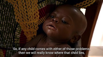 Addressing critical gaps in the treatment of severe acute malnutrition in Sierra Leone
