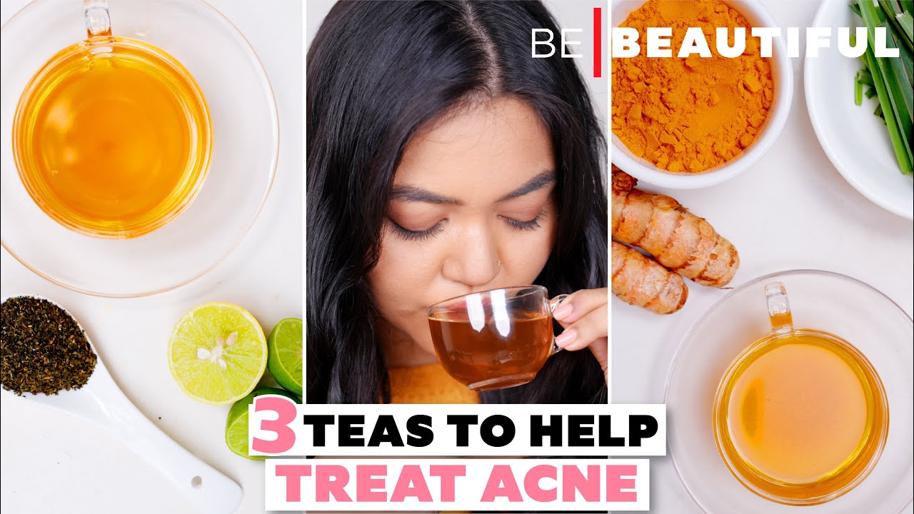 3 Teas To Help Treat Acne | How to Treat Acne | Acne Treatment | Skincare Routine | Be Beautiful