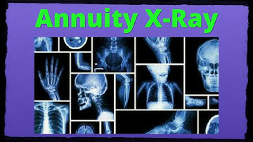 Variable Annuity M&E Fees - Explained