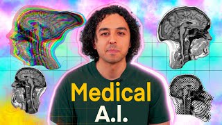 How AI Changed MRI Forever