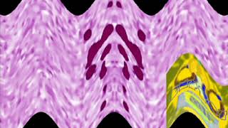 Crooked Klasky Csupo In Flanged Pulse Effect 9.0 Effects Sponsored By Klasky Pitch Effects