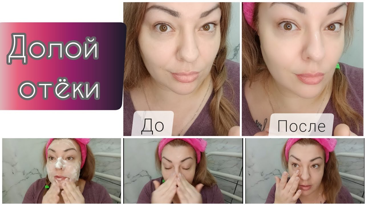 САМО СОВЕРШЕНСТВО 💃🏼 СПАСАЕМСЯ ОТ УТРЕННИХ ОТЕКОВ - ДО и ПОСЛЕ / ЛЮБИМЫЙ УХОД ФАБЕРЛИК 💁🏼‍♀️