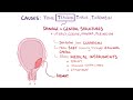 Postpartum hemorrhage - causes, symptoms, diagnosis, treatment, pathology