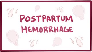 Postpartum hemorrhage - causes, symptoms, diagnosis, treatment, pathology screenshot 3