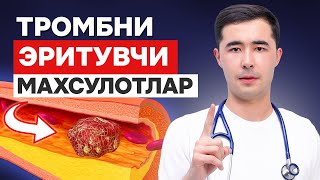 картинка: ТРОМБ ЭРИТУВЧИ ТОП 3 МАХСУЛОТ