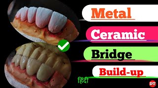 Metal Ceramic Bridge Build up| How to porcelain| Anatomy| Human Tooth| Dental Technician|Laboratory