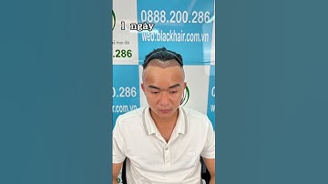 PHƯƠNG PHÁP KHẮC PHỤC HÓI CHỮ M ,