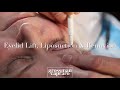 EYELID LIFT, LIPOSUCTION + RENUVION