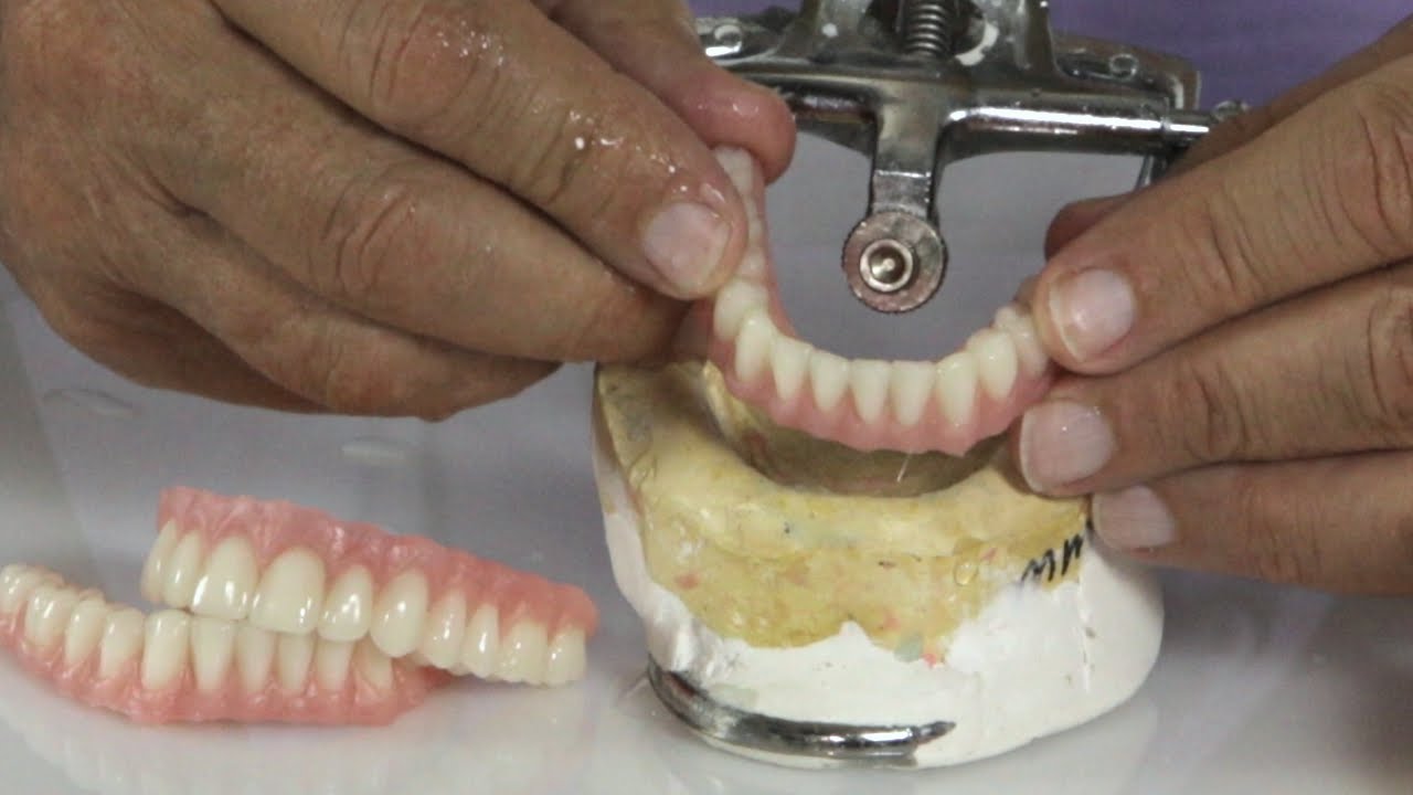 Instant Denture Setups | Good Fit ® Expedited Denture Systems - YouTube