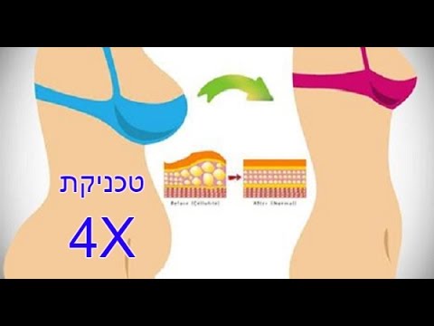 וִידֵאוֹ: איך מורידים 5 ק