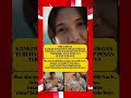 VIDI ALDIANO KENA KANKER #short #shortviral #fypシ