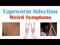 Weird symptoms of tapeworm infection skin psychological neurological