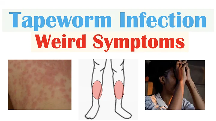 Weird Symptoms of Tapeworm Infection (Skin, Psychological, Neurological) - DayDayNews