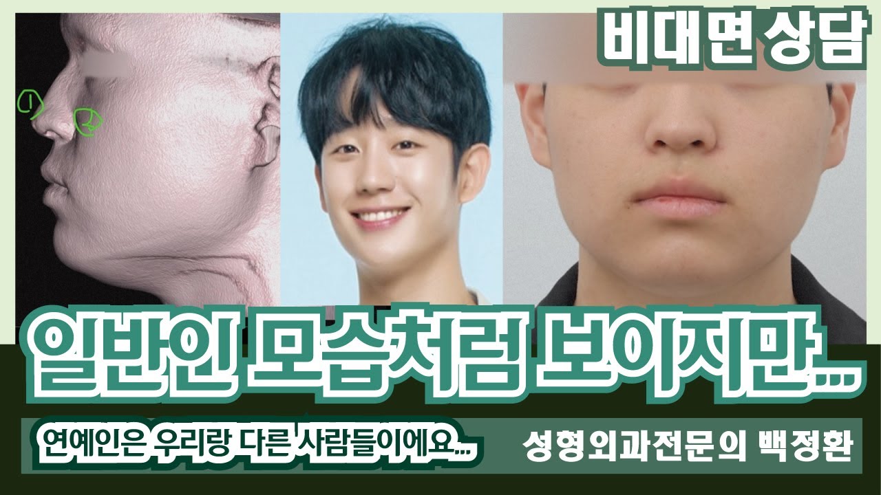 (SUB) 연예인들은 우리랑 다른 사람들이에요... [비대면상담 309] / Celebrities are different people from us...