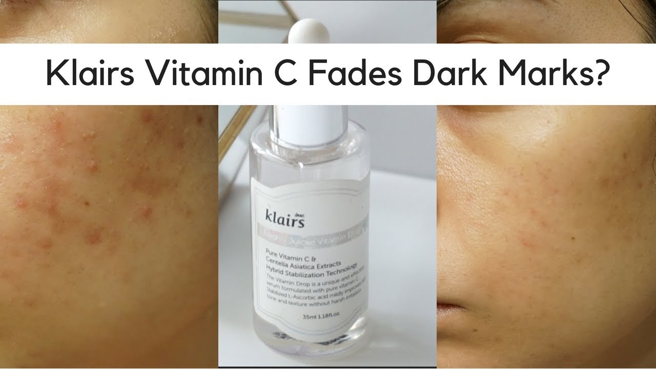 Klairs Freshly Juiced Vitamin C Review Best Serum For Dark Marks