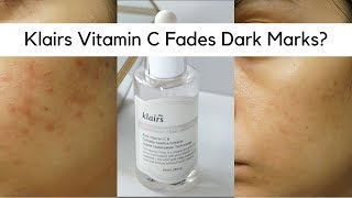 Rosácea c klairs vitamina soro