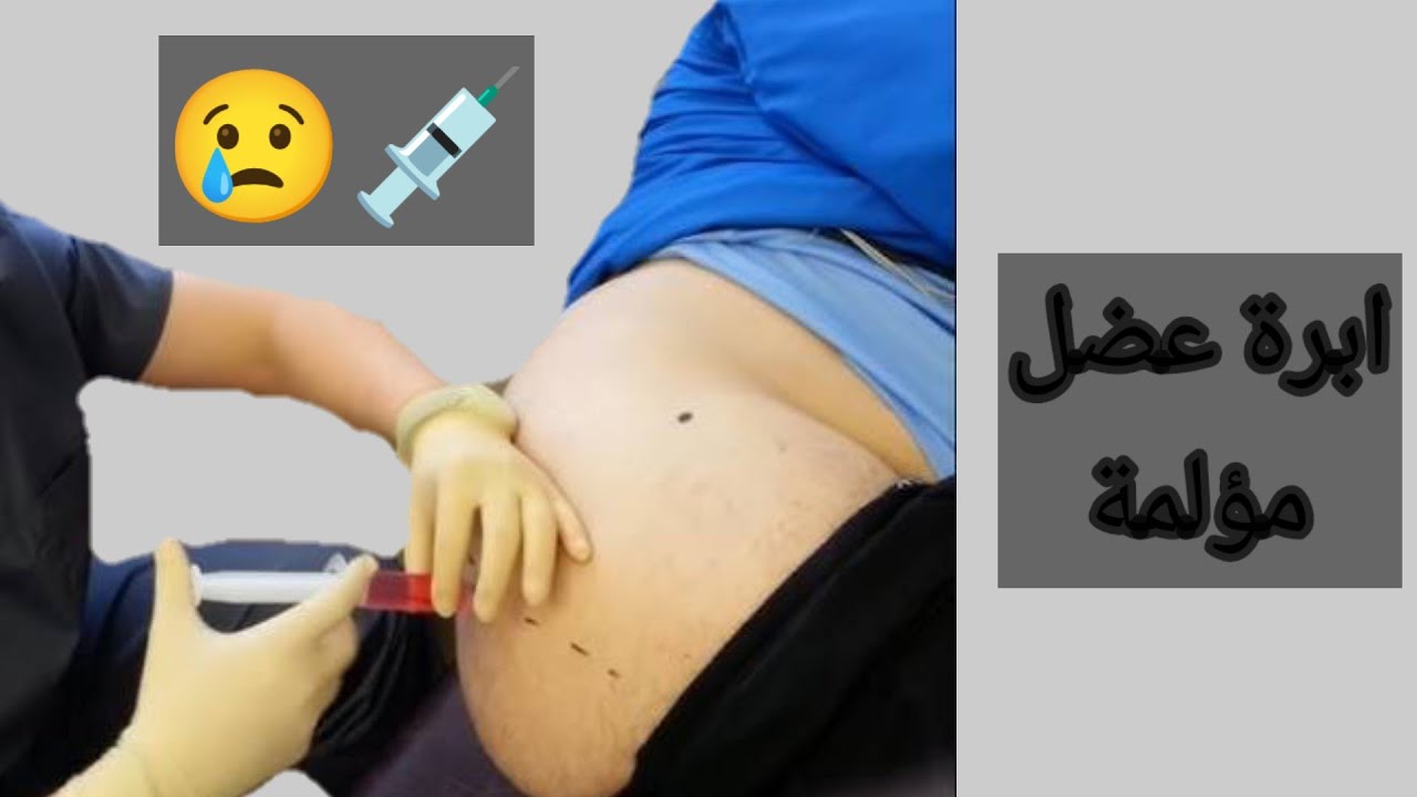 ابرة عضل للبرد والترجيع الشديد مؤلمه جدا injection - YouTube