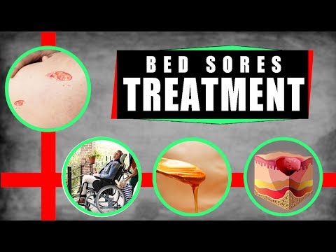 Video: Remedie vir weeluise in die apteek. Wat veroorsaak bedbugs? Weeluis voorbereidings