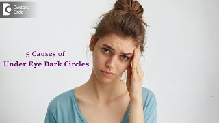 5 Top Causes of Dark Circles | Know what Causes Dark Circles? - Dr. Renuka Shetty | Doctors' Circle