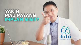 Implan Gigi!? Eitss, tunggu dulu.. udah tau yang ini belom?