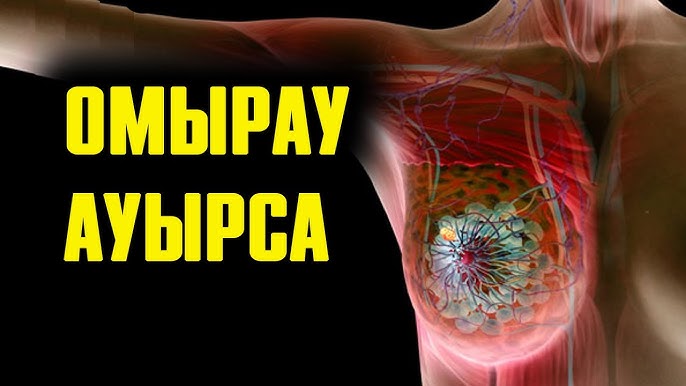 Орысша спермага көмек сұрайды