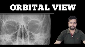 ORBIT AP LAT OBL VIEWS