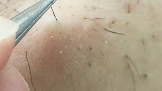 ひげぬき79 楽天市場で買った超精密ピンセット890円レビュー