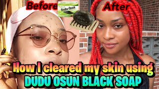 HOW I CLEARED MY DARK SPOTS|My Skin Journey|Skincare